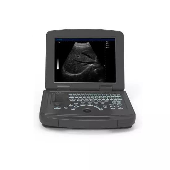 Portable Laptop type gynecology diagnostic  medical ultrasound instruments